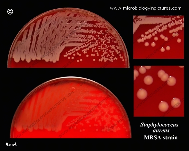 MRSA on blood agar. Methicillin resistant Staphylococcus aureus.